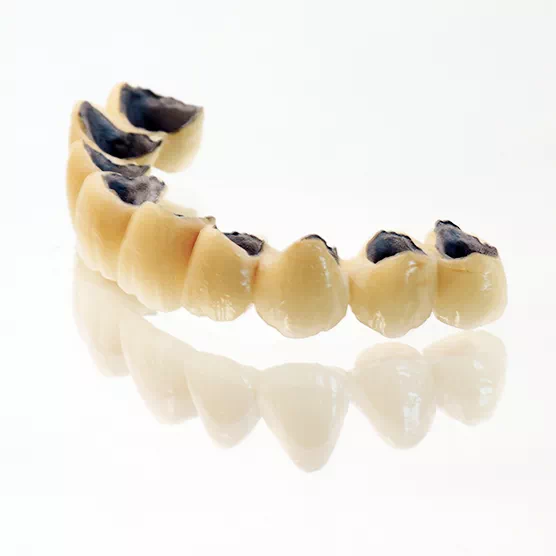ceramometal