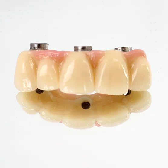 suprastructures_4